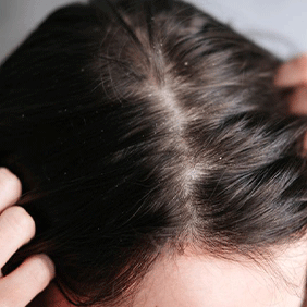Scalp and Deep conditioning treatment